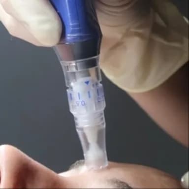 MICRONEEDLING PACKAGE of 3 at THE FLORIDA FACIALIST in Delray Beach, FL